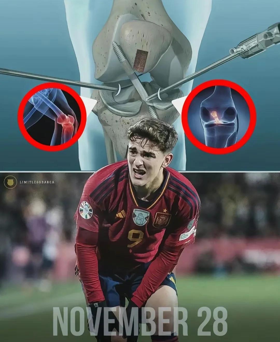 斯图加特球员紧急受伤,或将缺席比赛(斯图加特主力球员) 斯图加特球员紧急受伤,或将缺席比赛(斯图加特主力球员)